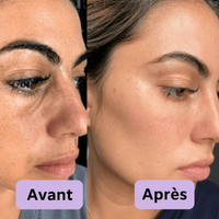 PeelShot™ | Ampoule exfoliante au riz pour les pores et l’éclat