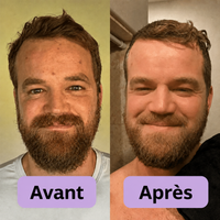 PeelShot™ | Ampoule exfoliante au riz pour les pores et l’éclat