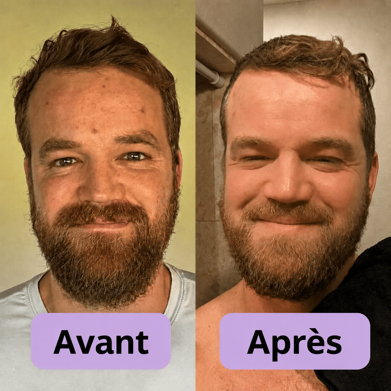 PeelShot™ | Ampoule exfoliante au riz pour les pores et l’éclat