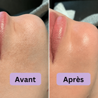 PeelShot™ | Ampoule exfoliante au riz pour les pores et l’éclat