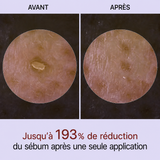 PeelShot™ | Ampoule exfoliante au riz pour les pores et l’éclat