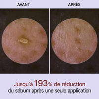 PeelShot™ | Ampoule exfoliante au riz pour les pores et l’éclat