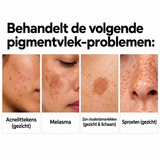 SpotFade™ | Minder zichtbare vlekjes, meer glow