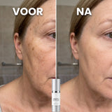 SpotFade™ | Minder zichtbare vlekjes, meer glow