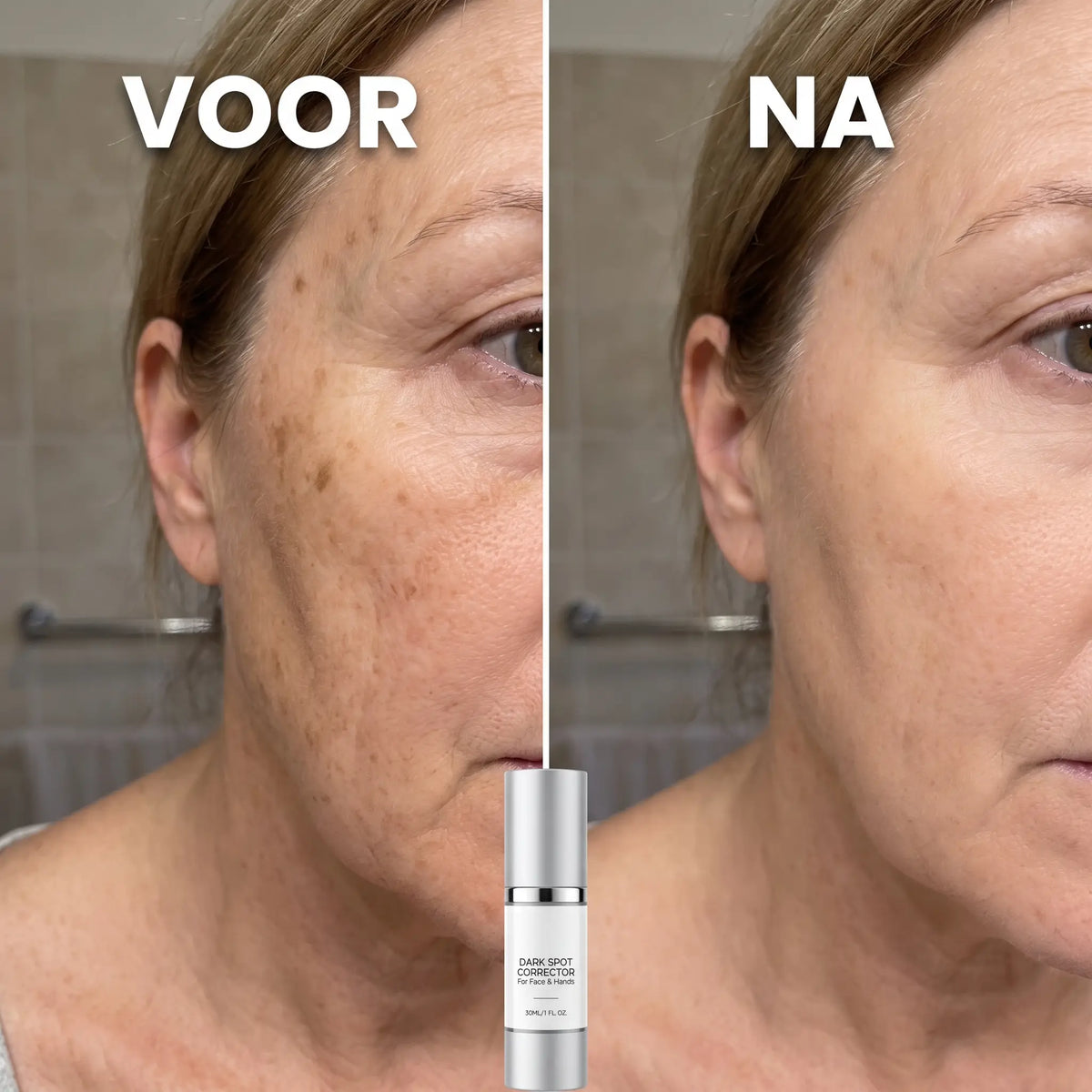 SpotFade™ | Minder zichtbare vlekjes, meer glow